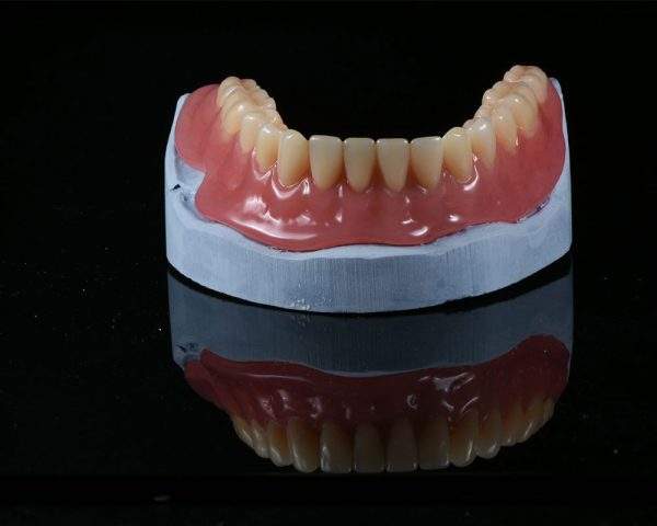 Acrylic Denture