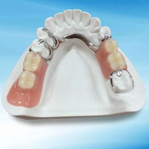 Framework with Arcylic Partial Denture