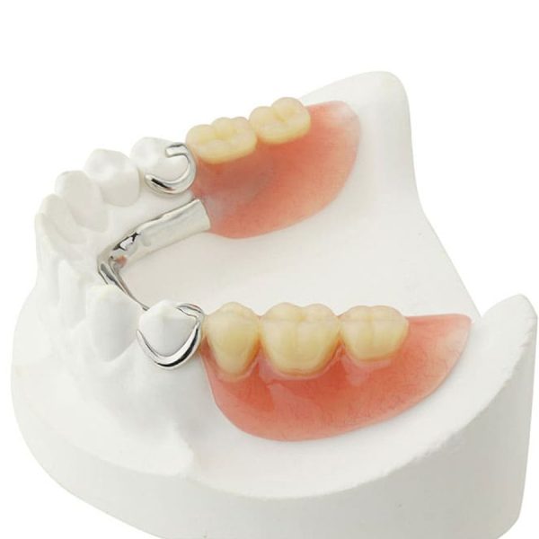 Framework with Arcylic Partial Denture