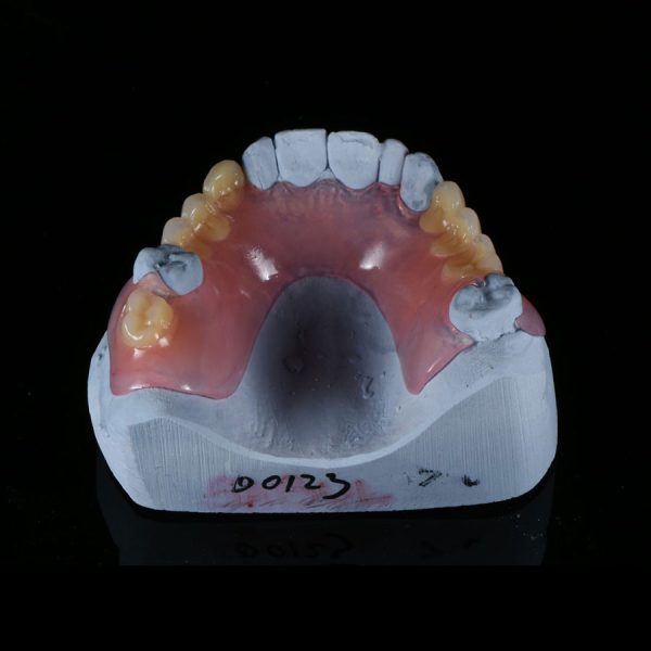 Valplast partial denture