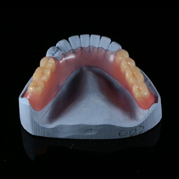 Valplast partial denture