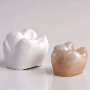 Zirconia Crown