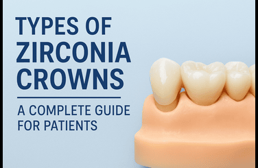 Types of Zirconia Crowns : A Complete Guide for Patients | Hydental Lab