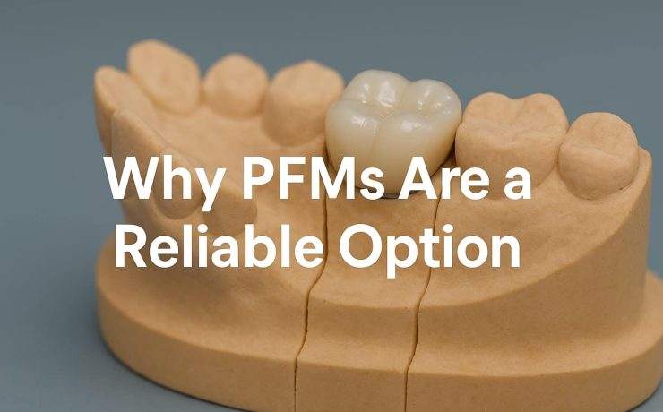 Why PFMs Are a Reliable Option